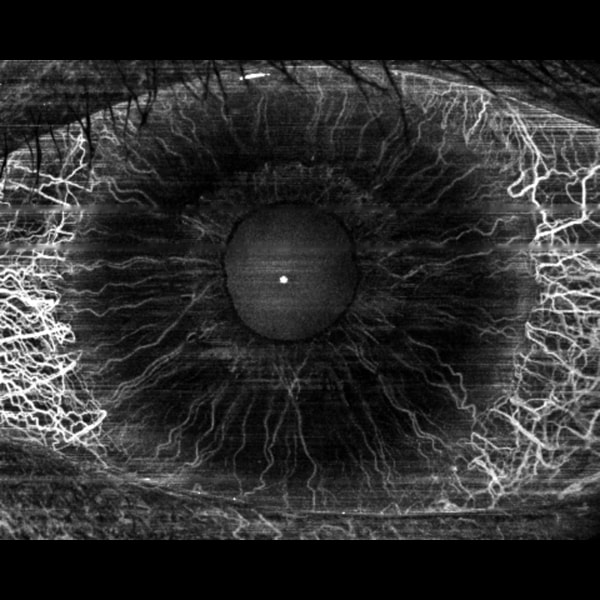 DREAM OCT VG 200D